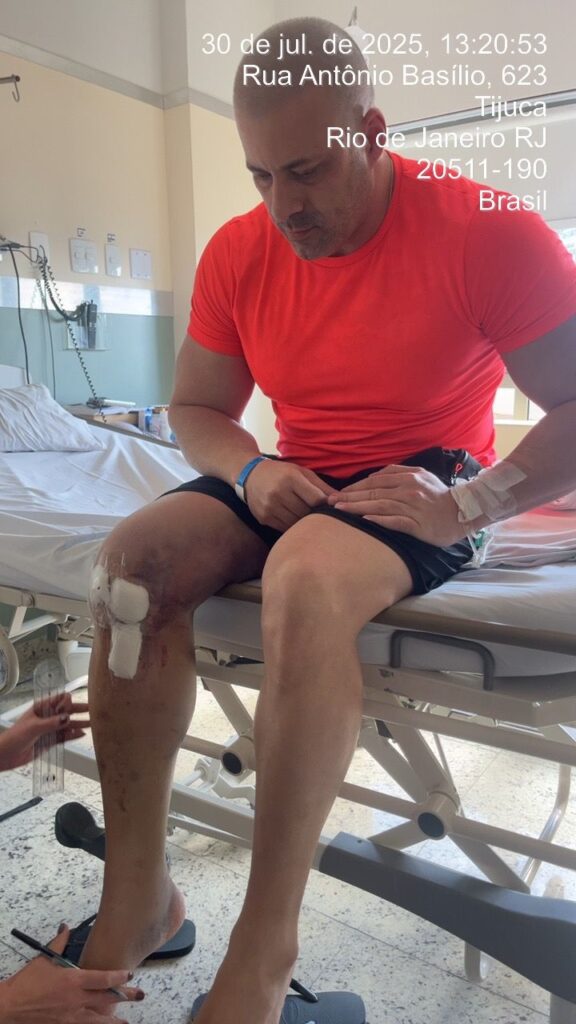Daniel Silveira passou por cirurgia no joelho em julho e realizava fisioterapia fora da prisão também por decisão de Moraes