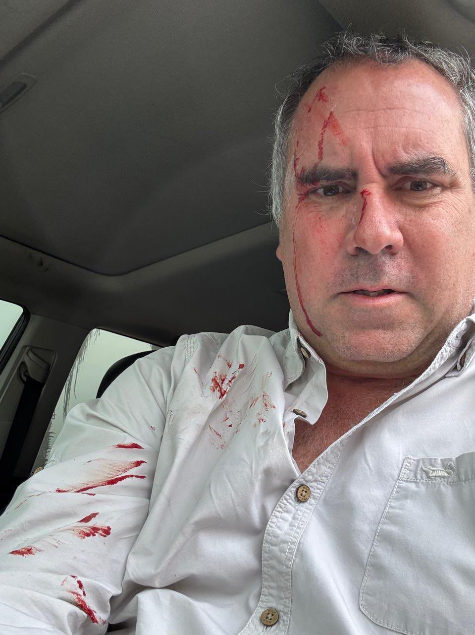 O candidato, que é neto do ex-presidente peruano Fernando Belaúnde, saiu ileso, mas seu veículo foi atingido por pelo menos três disparos
