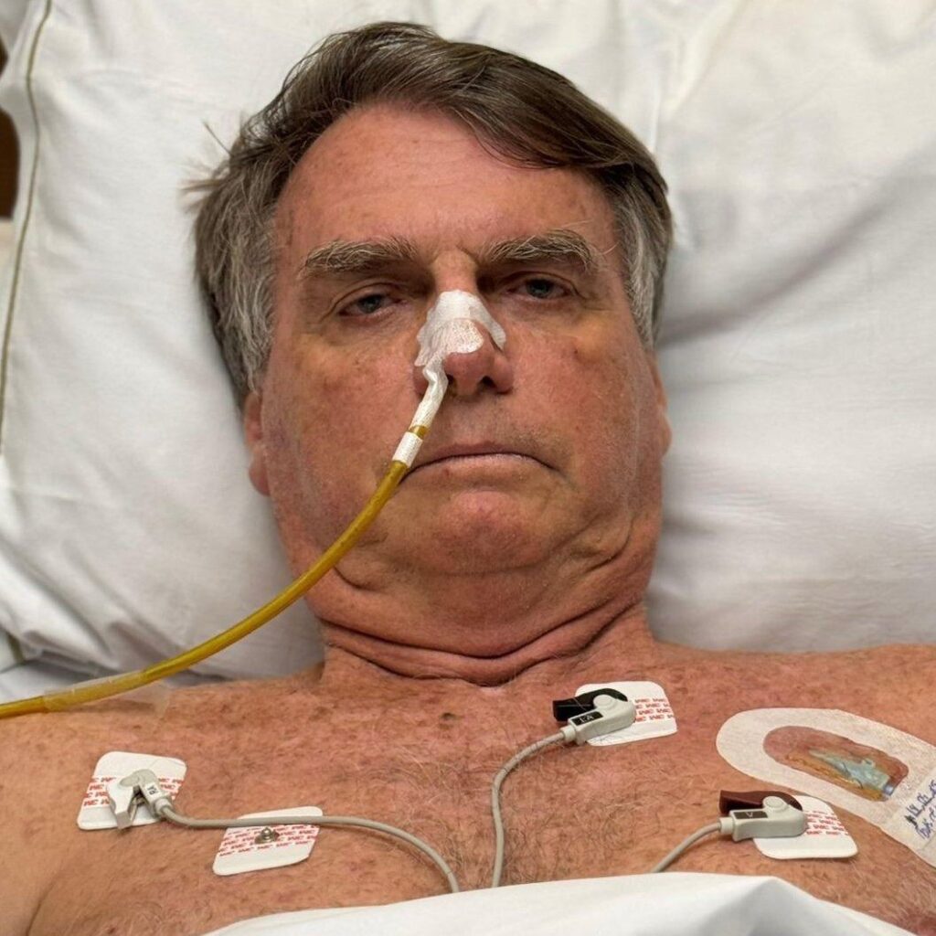 Brasil - Segundo Michelle, o incidente ocorreu após uma crise não especificada, e Bolsonaro bateu a cabeça em um móvel.. Foto: Reprodução.