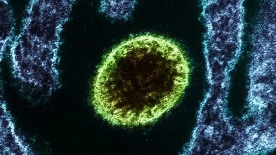 Países asiáticos retomam protocolos de pandemia diante do vírus Nipah